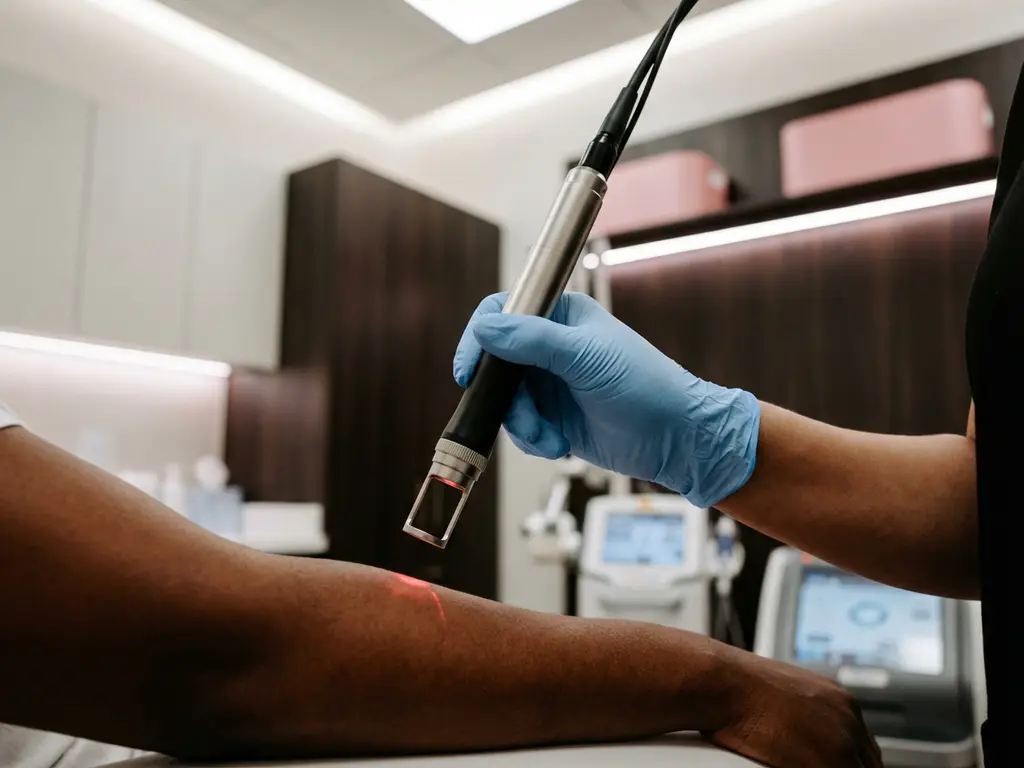 Handgeschoende clinicus positioneert CO2-laserhandstuk boven donkere huid op onderarm in medisch-esthetische behandelkamer.