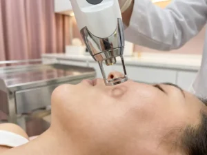 CO2-laserhandstuk boven gladde gezichtshuid tijdens cosmetische laserbehandeling in witte klinische omgeving.