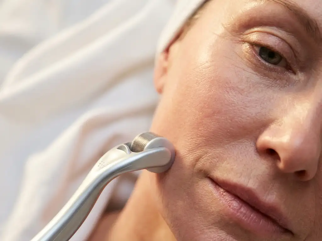Volwassen vrouwenhuid bij jukbeen met microneedling apparaat tegen de kaaklijn, zachte klinische achtergrond.