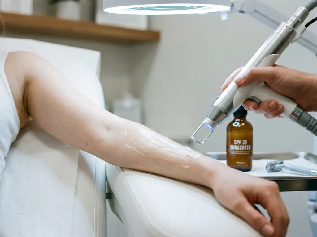 Vrouwenonderarm op klinisch witte ondergrond met laserhandstuk, zonnebrand en scheermesje tijdens laserharbehandeling.